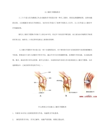 完整word版,人工膝关节置换手术步骤全解