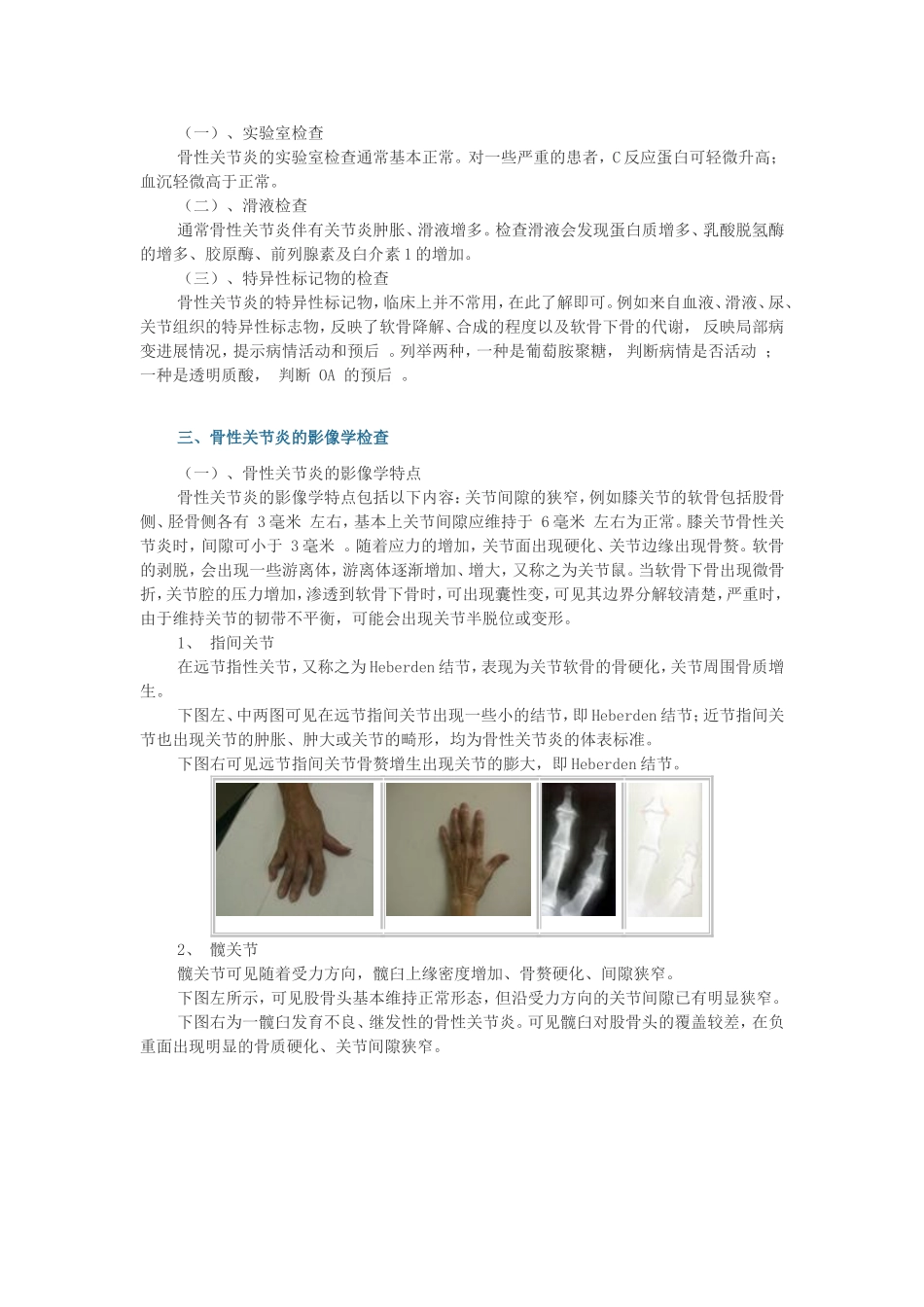 骨关节病的诊断和鉴别诊断_第3页