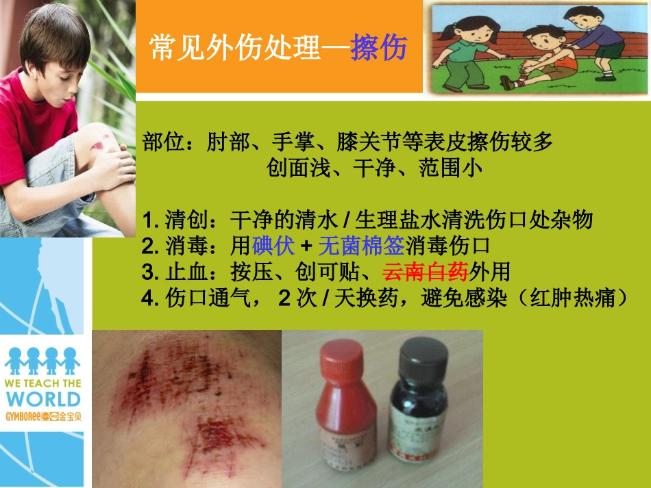 儿童常见外伤的预防及处理.ppt_第3页