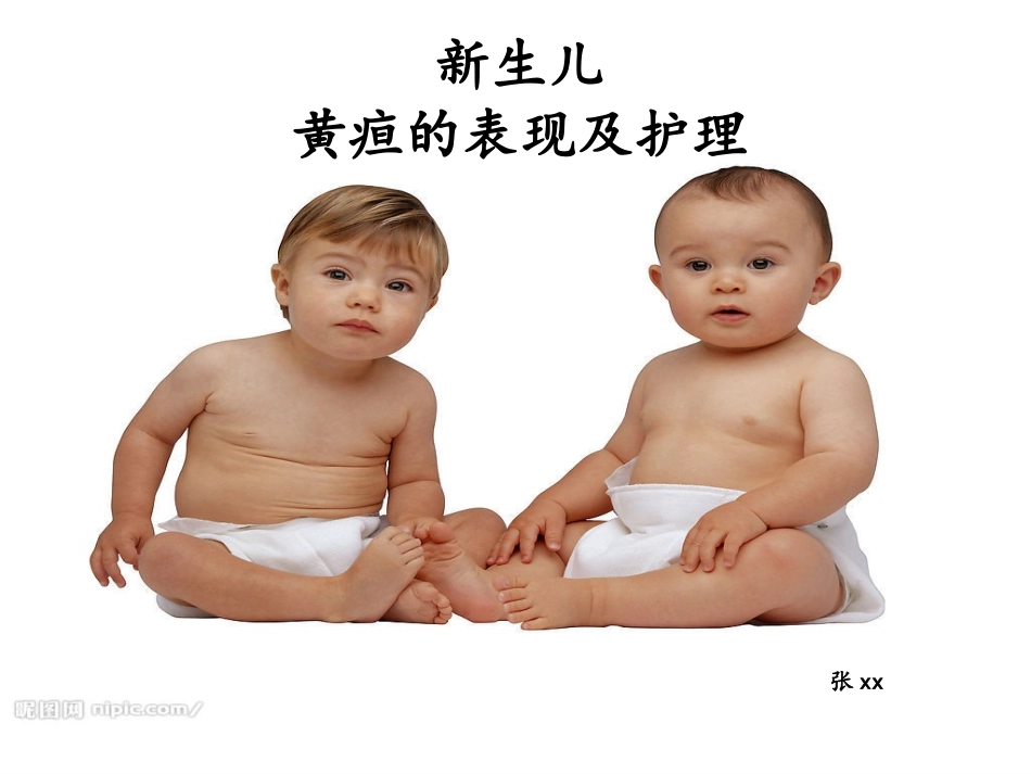 新生儿黄疸的表现及护理_第1页