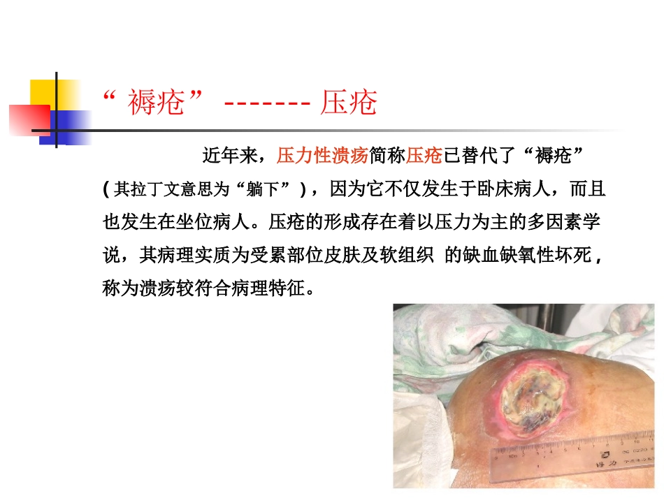 压疮的预防及护理_第3页