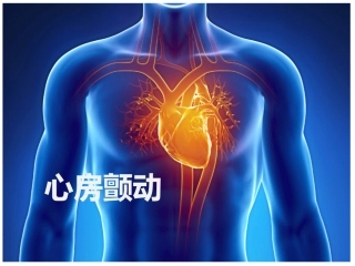 最新房颤管理指南