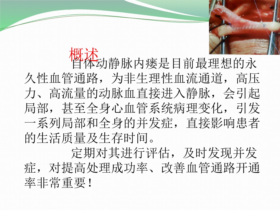 自体动静脉内瘘并发症处理_第2页