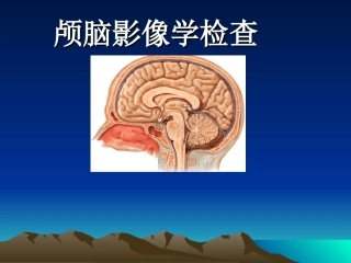 颅脑影像学检查