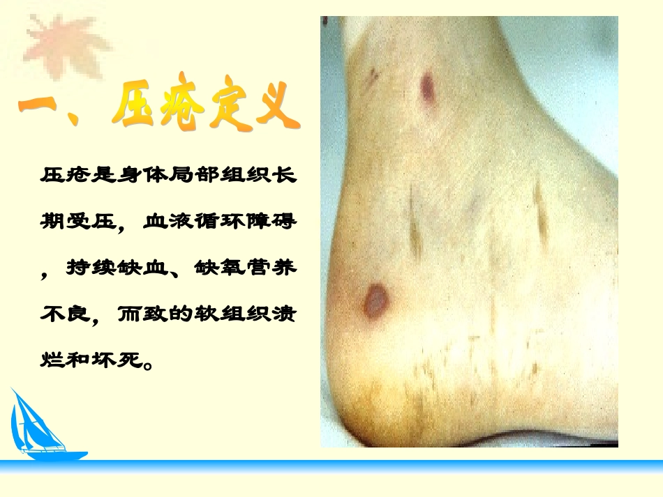 压疮预防及护理ppt_第3页