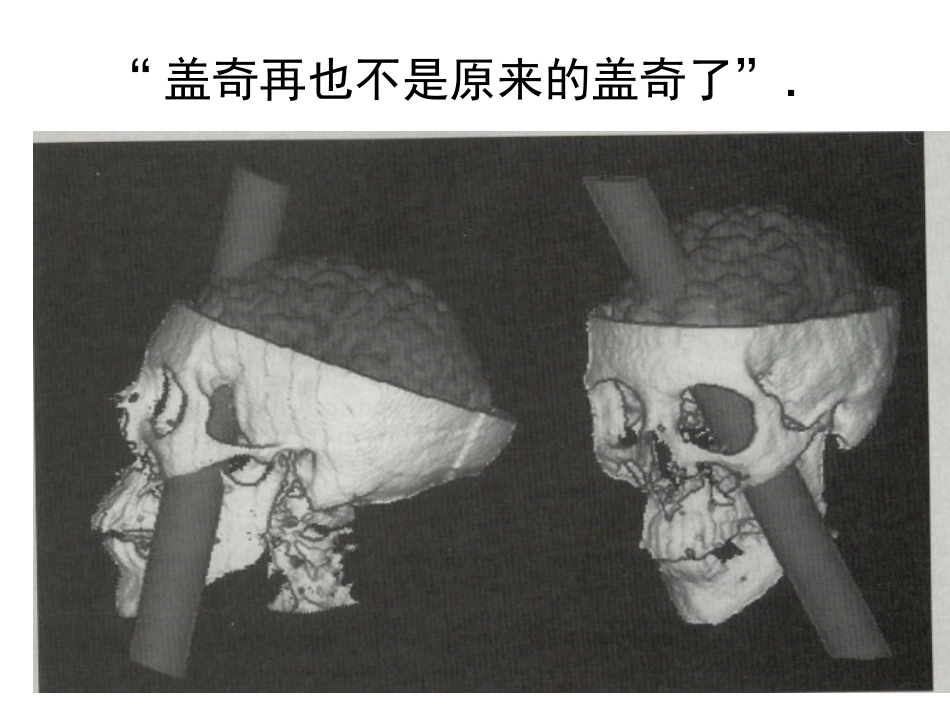 彭聃龄《普通心理学》 第02章 心理的神经生理机制_第2页