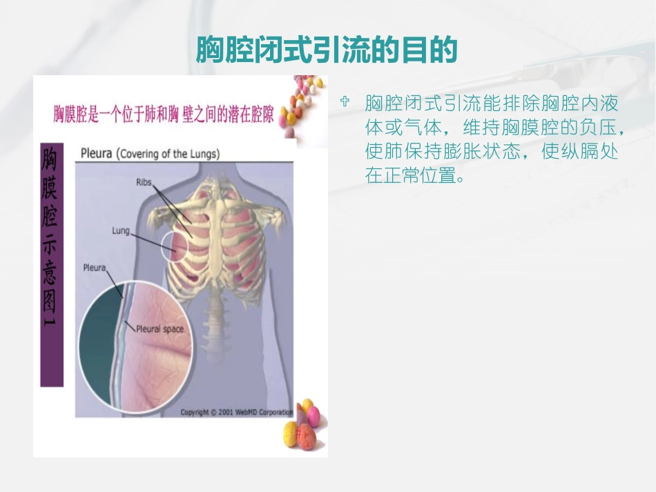 胸腔闭式引流的护理及注意事项_第3页