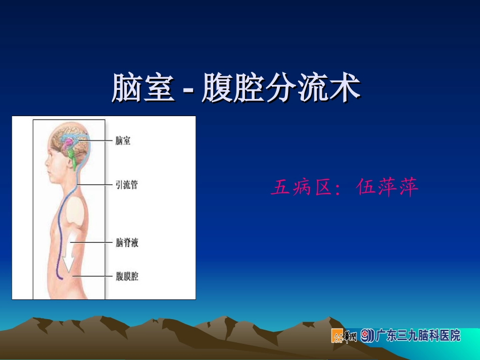 脑室-腹腔分流术_第1页