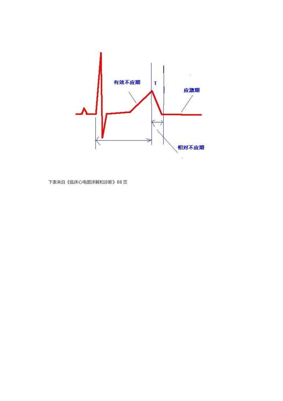 早搏的诊断和鉴别诊断_第2页