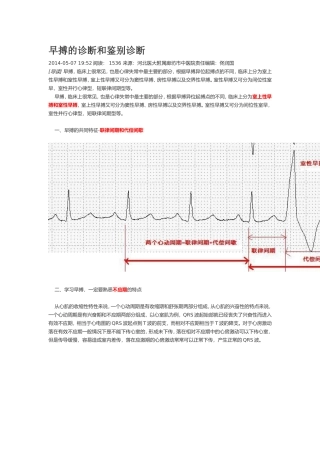 早搏的诊断和鉴别诊断