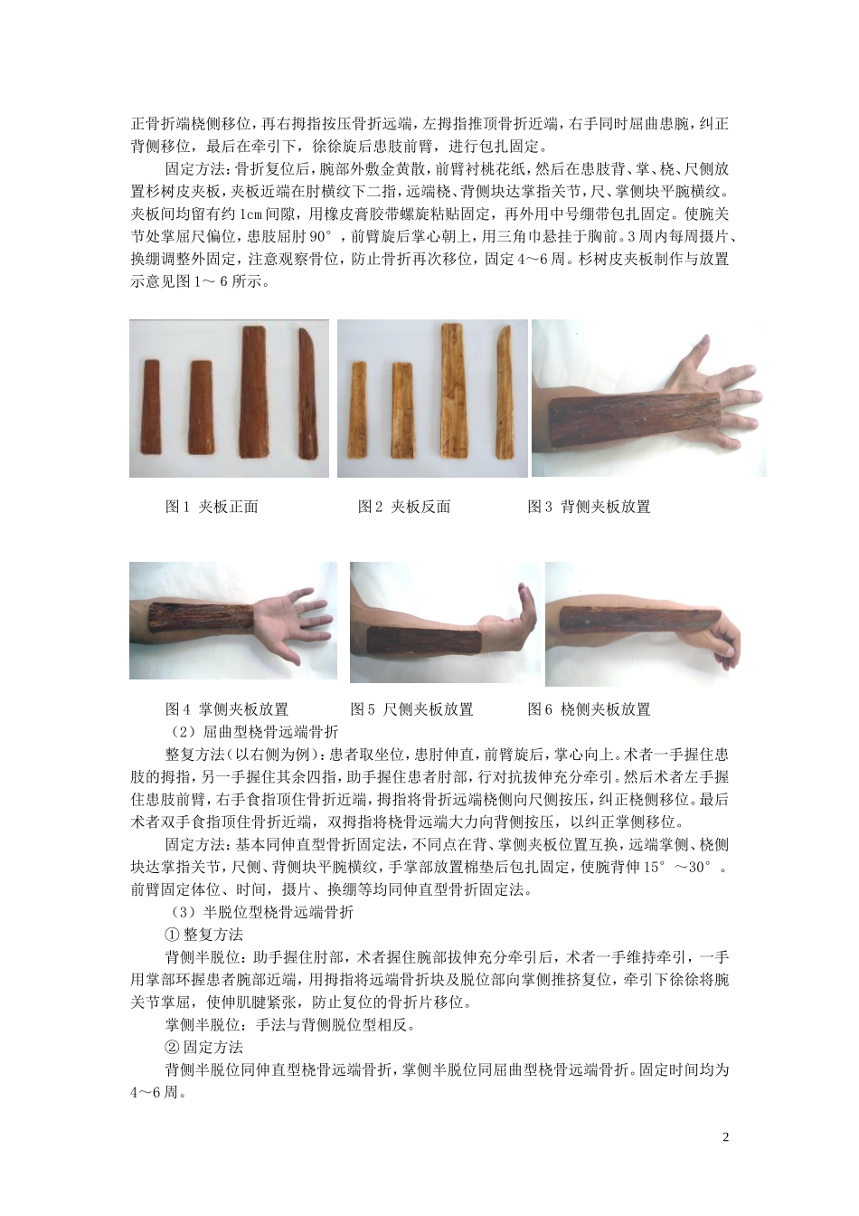 桡骨远端骨折诊疗方案_第2页