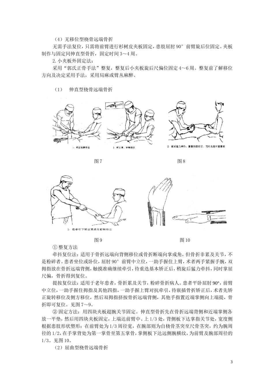 桡骨远端骨折诊疗方案_第3页