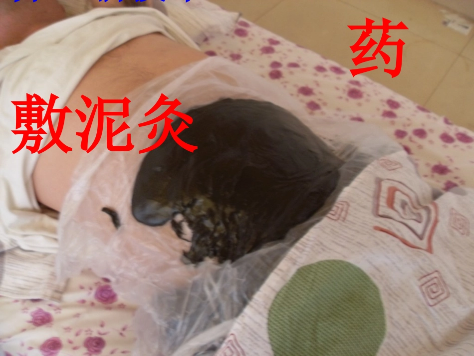 养生新技术—药敷泥炙_第1页