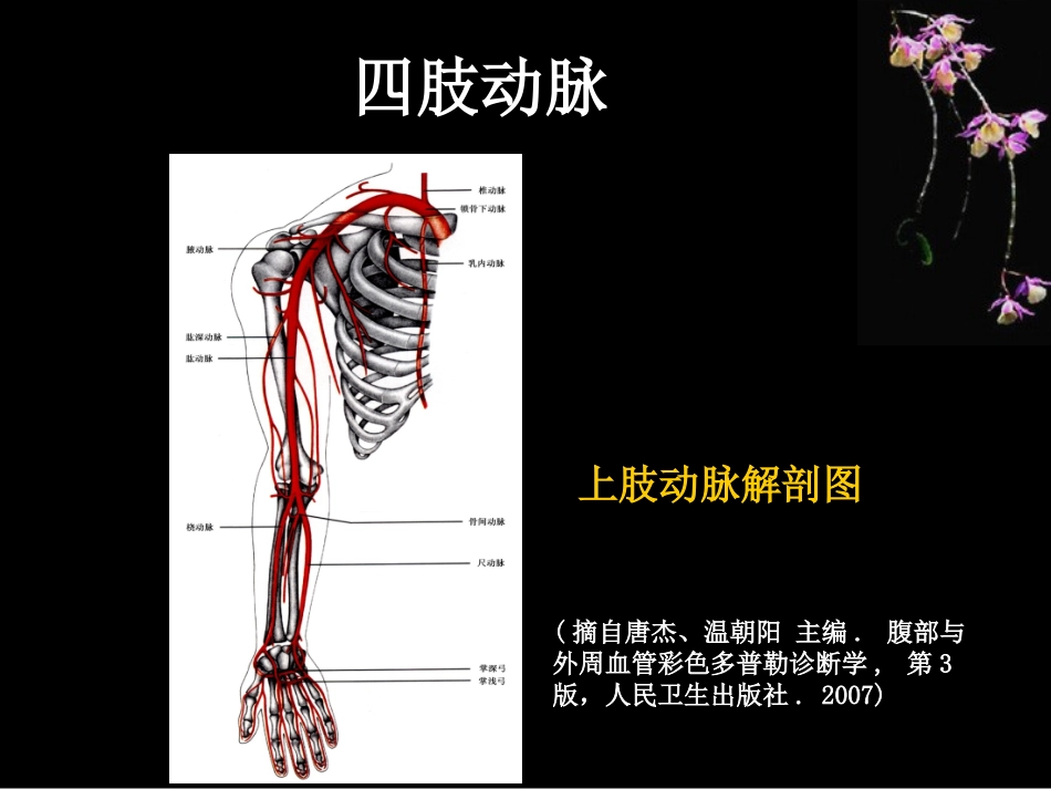 外周血管超声表现_第2页