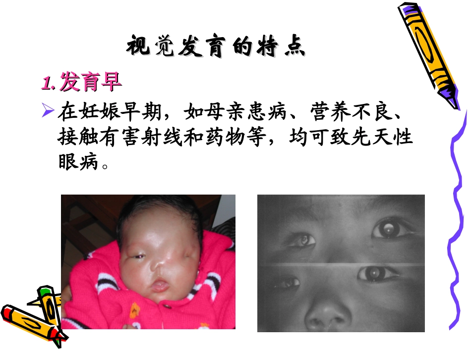 近视眼的防控_第2页