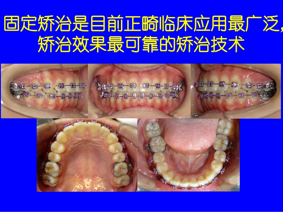 口腔正畸基础学_第2页