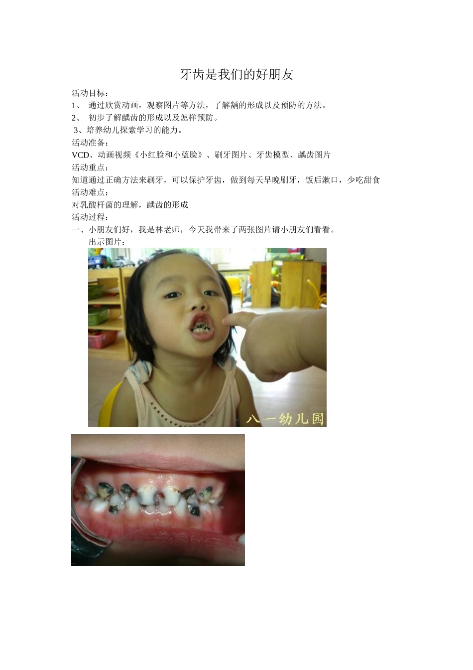 牙齿是我们的好朋友_第1页