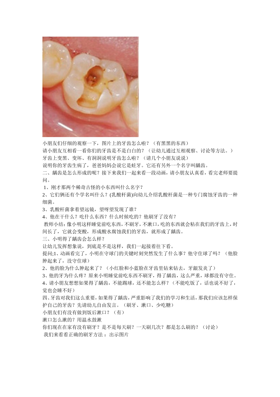 牙齿是我们的好朋友_第2页