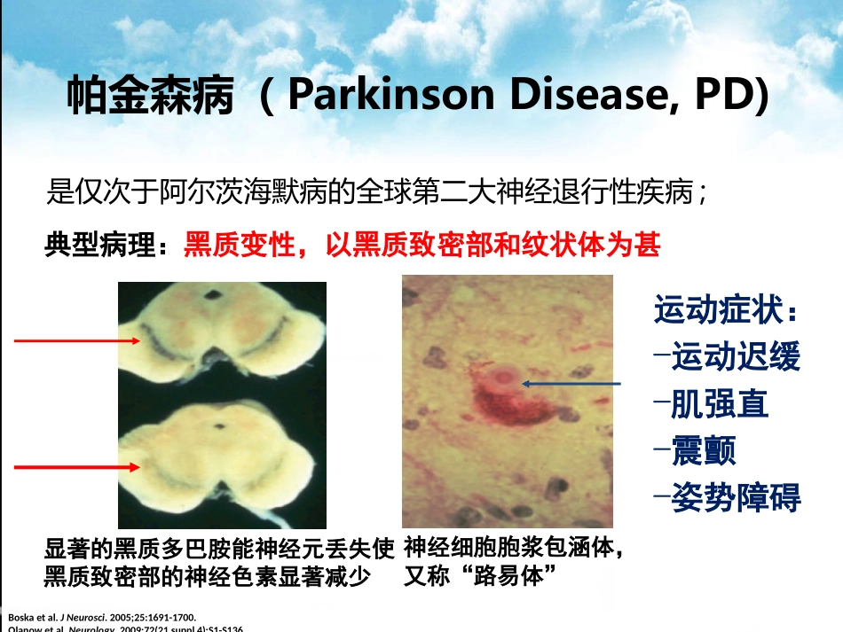 帕金森病剂末现象的治疗策略_第3页