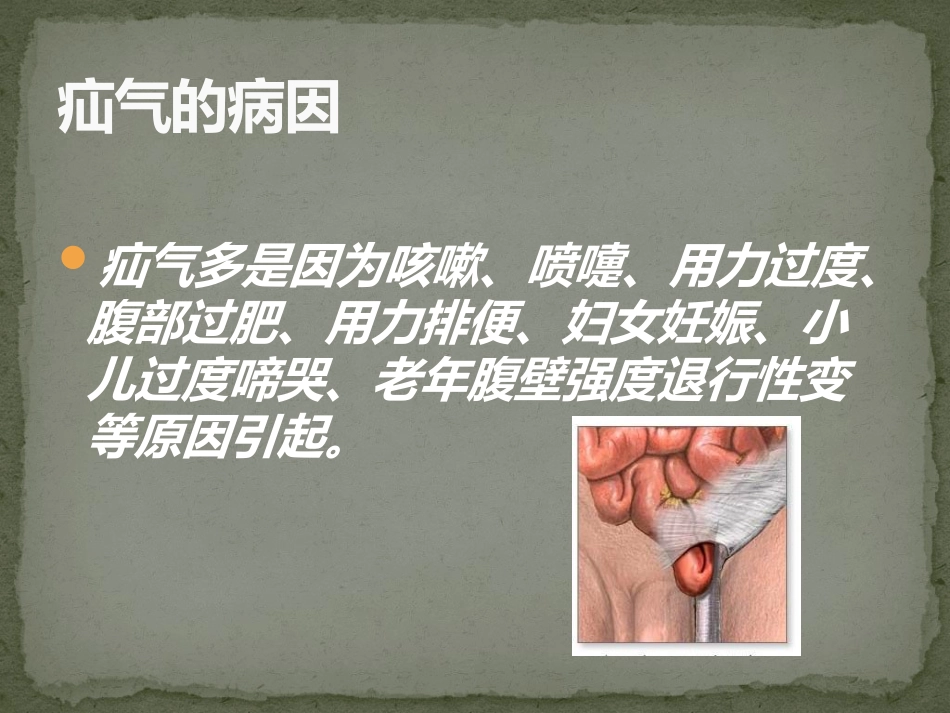 无张力疝修补术手术配合_第3页