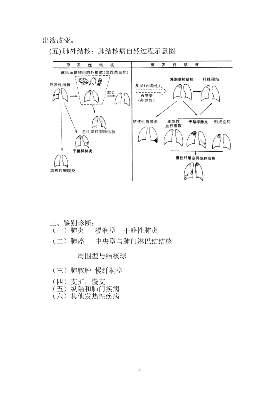 结核病的诊断标准_第3页