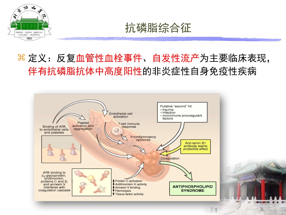 抗磷脂综合征诊治策略_第2页