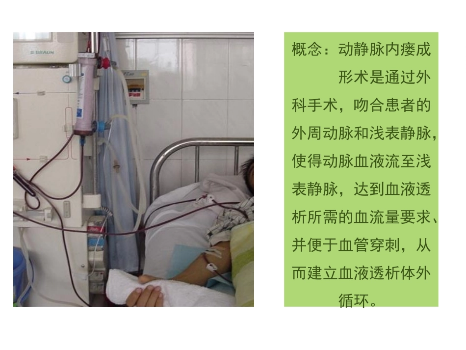 动静脉内瘘的护理与观察_第2页