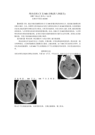 脑结核CT诊断及MRI诊断