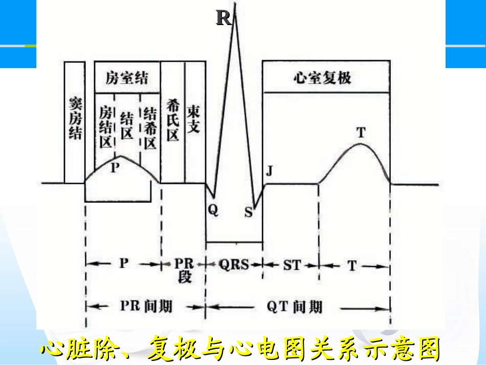 心电图基础图解_第3页
