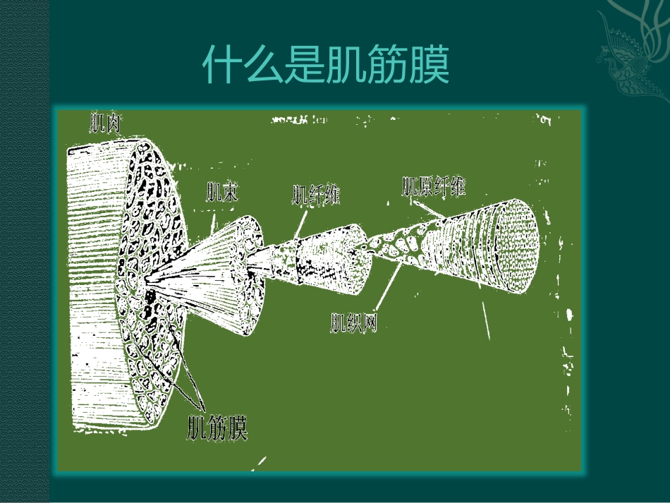 筋膜疼痛与扳机点_第2页