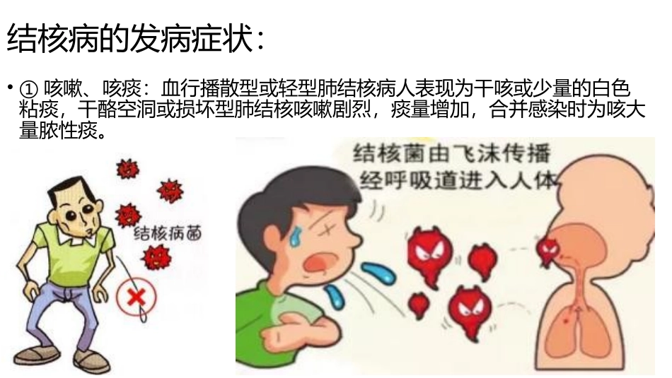 预防结核病PPT_第3页