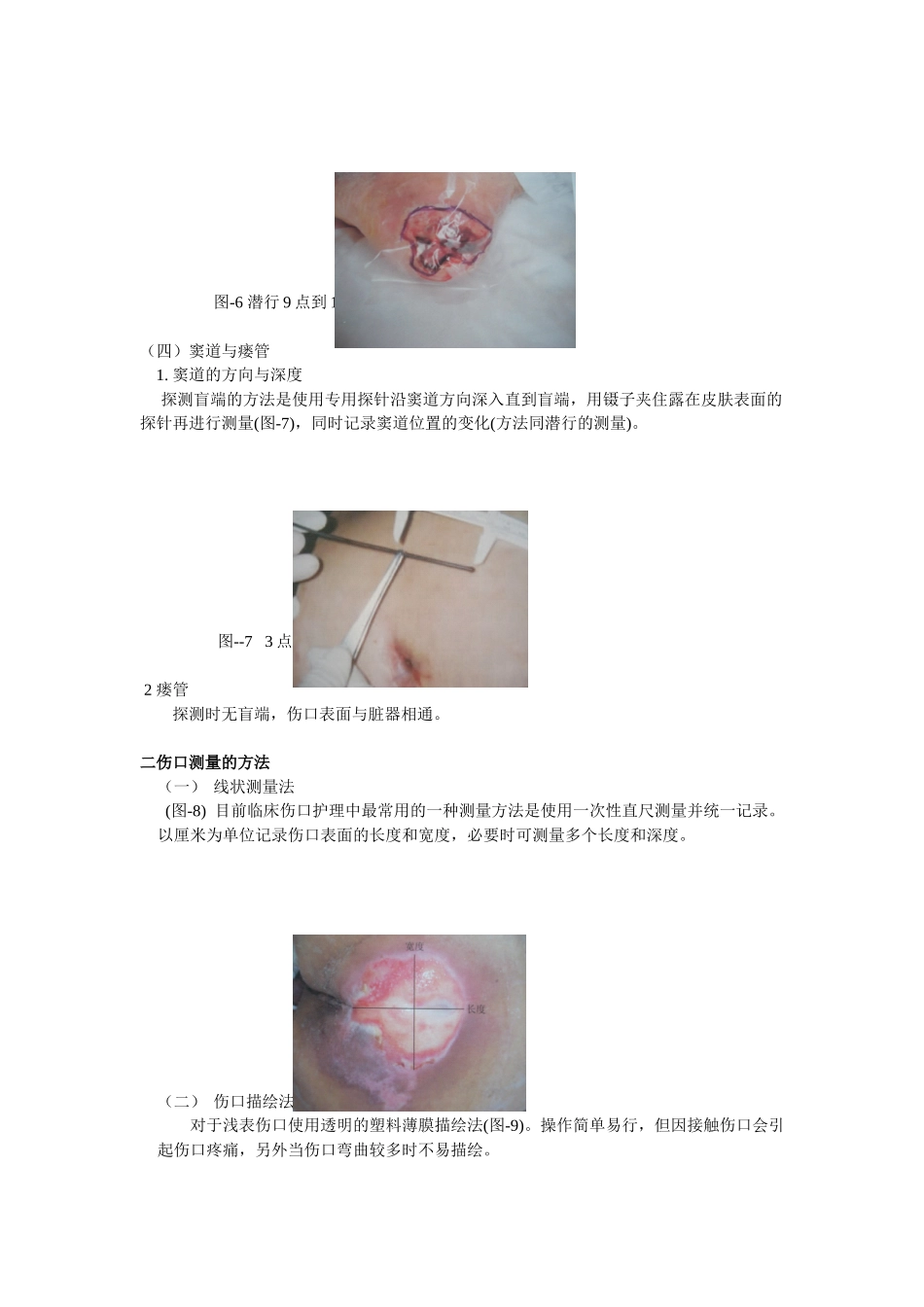 伤口测量解析_第2页