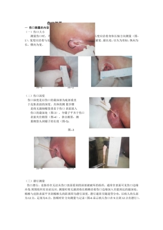 伤口测量解析