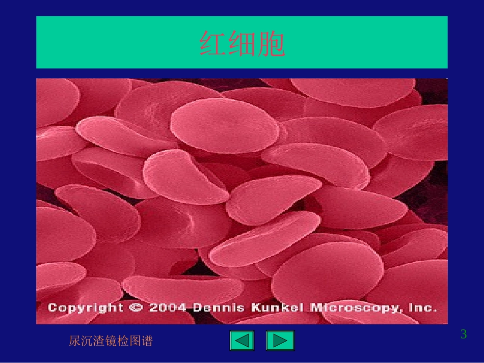 尿沉渣镜检图谱_第3页