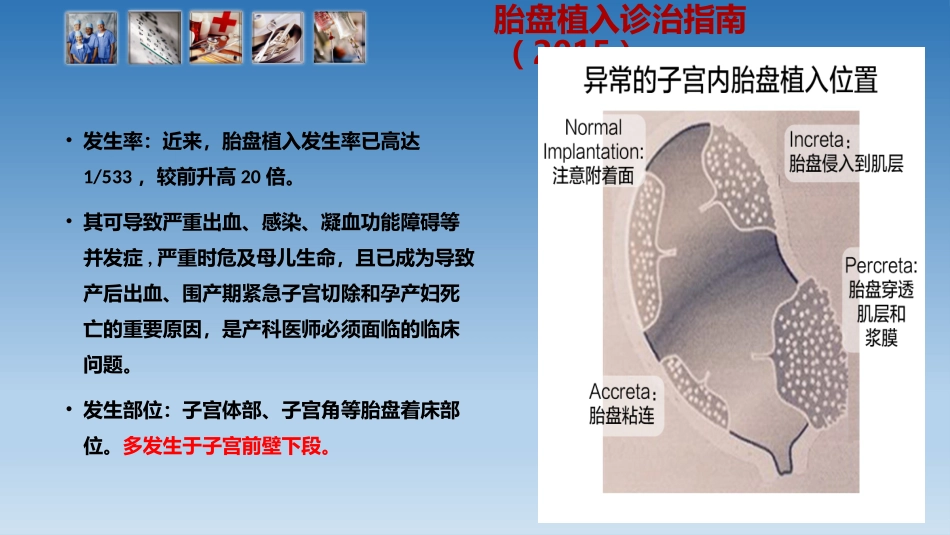 胎盘植入MR诊断_第3页