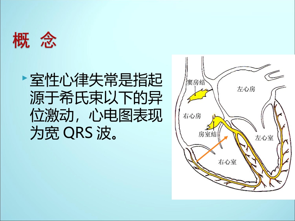 室性心律失常诊断与治疗_第2页