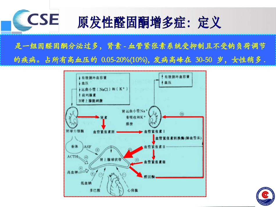 原发性醛固酮增多症专家共识2016-WD-1_第2页