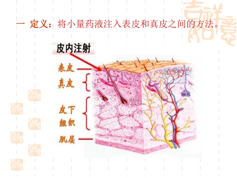 皮内注射(ID)_第3页