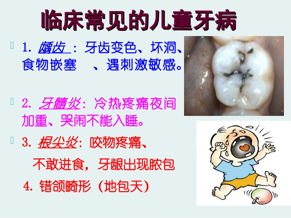 儿童牙病的预防.ppt_第2页