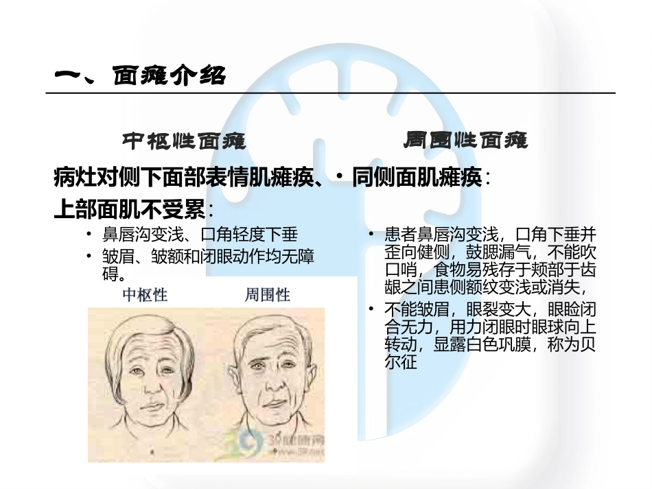 中枢性面瘫和周围性面瘫的区别_第3页