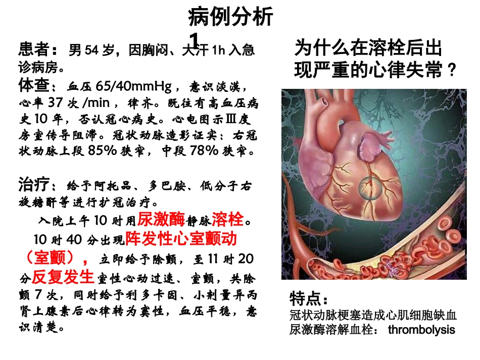 缺血再灌注损伤_第2页