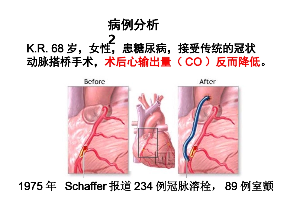 缺血再灌注损伤_第3页