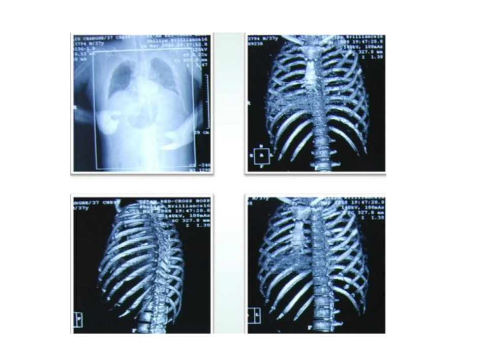 重症监测治疗与复苏_第3页