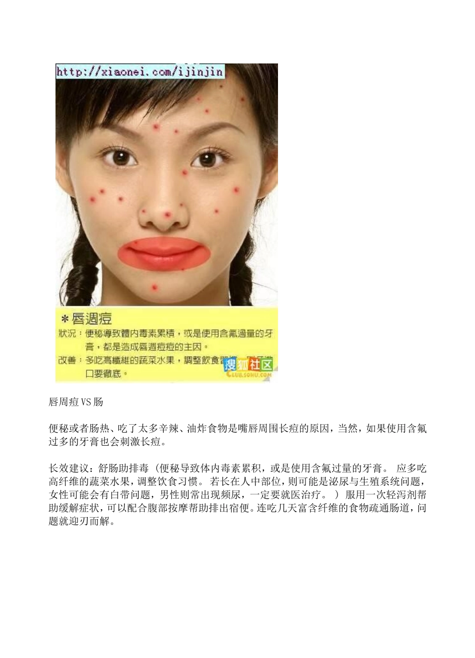 额头痘VS肝脏_第3页
