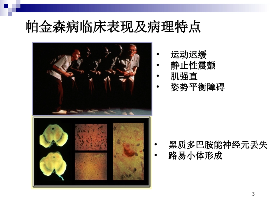 帕金森病中医药治疗探索_第3页