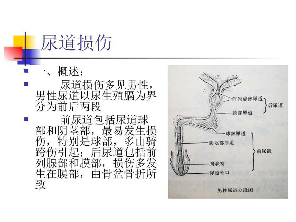 尿道损伤病人的护理_第3页