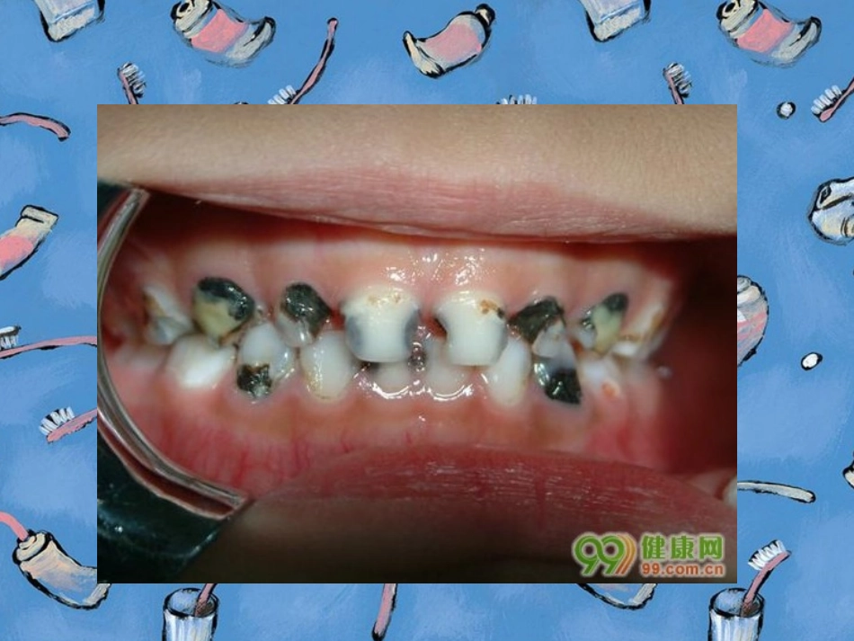 小熊不刷牙1_第2页