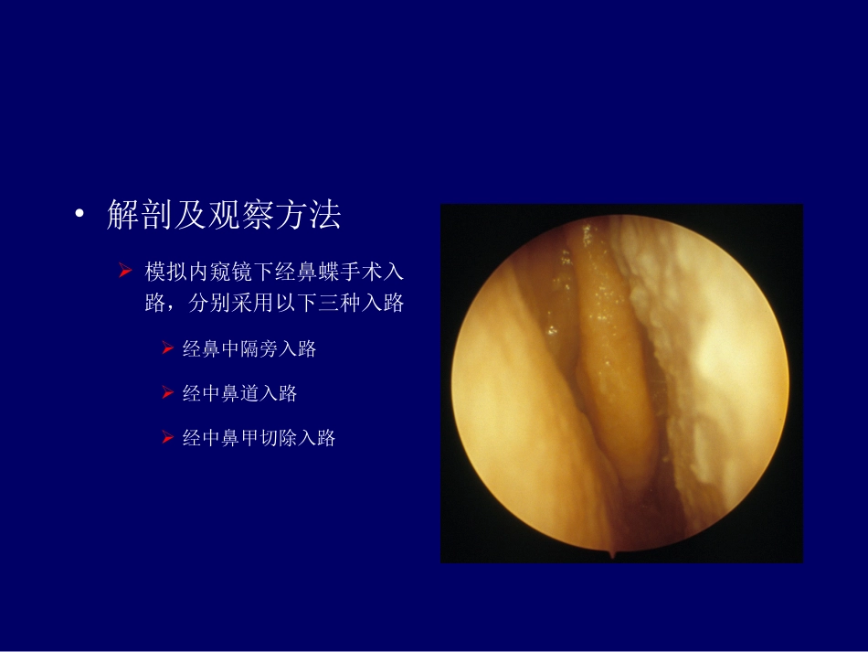 经单孔-鼻蝶入路切除鞍区病变的显微解剖与临床手术技巧_第3页