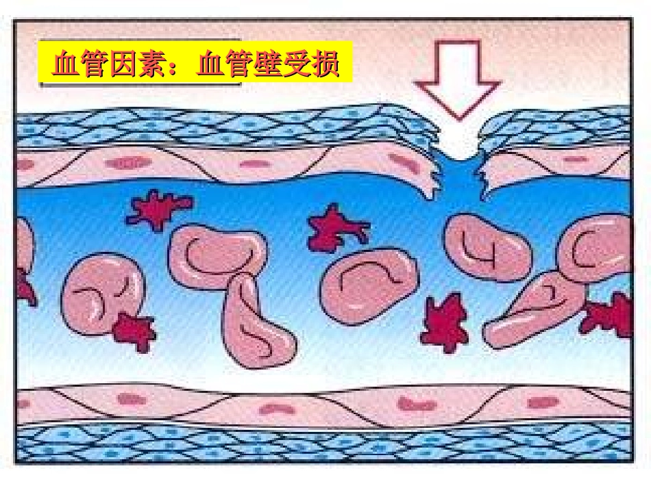付文金---凝血项目在妇产科的应用_第3页