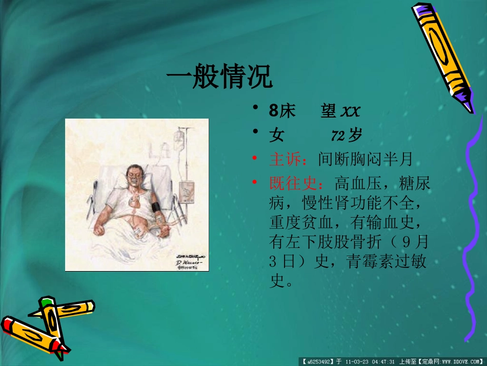 心绞痛护理查房_第2页